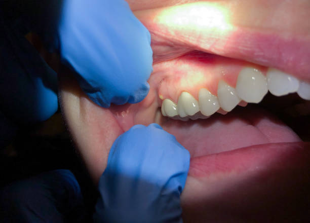 Best Emergency Treatment for Oral Infections in Anthony, TX