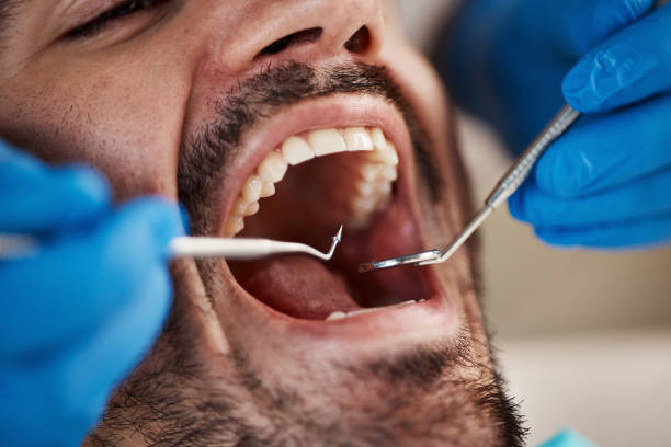 Best Emergency Care for Gum Disease in Anthony, TX